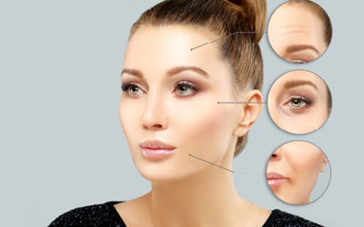 Botox Malaysia – Treating Muscle Contraction Caused Wrinkles